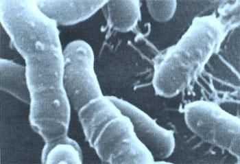 Условия, необходимые для продуктивной работы анаэробных бактерий